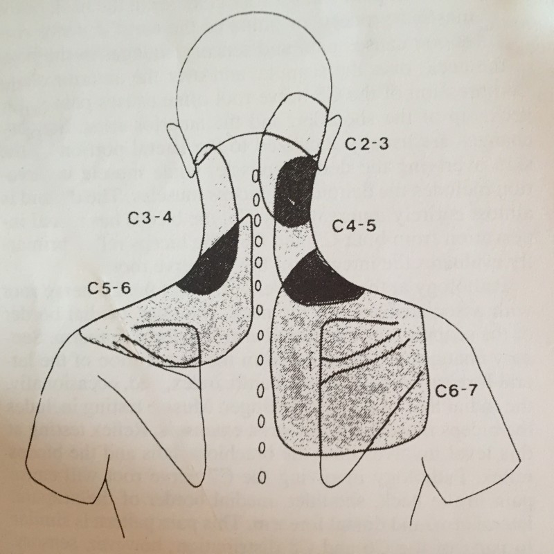 degenerative-disc-disease-cervical-thoracic-lumbar-spinecare